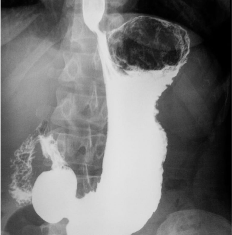 GI Fluoroscopy - Insight Medical Imaging