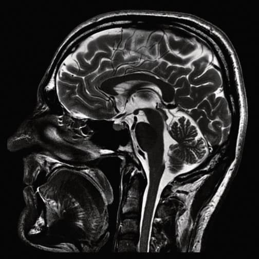 Magnetic resonance imaging scan of brain from Alberta clinic