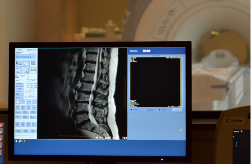 Spine MRI - Insight Medical Imaging