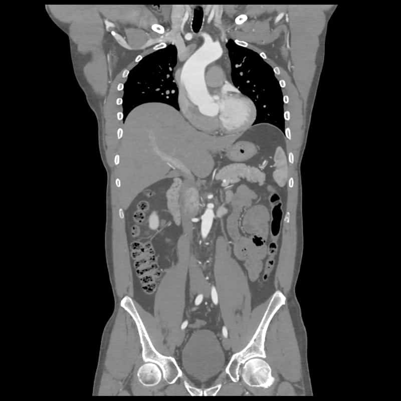 Whole body CT scan from clinic in Edmonton