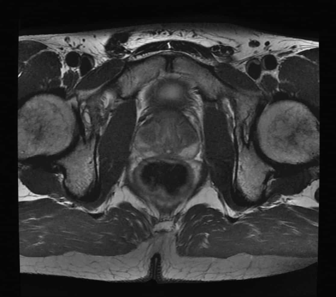 Pelvic MRI Insight Medical Imaging