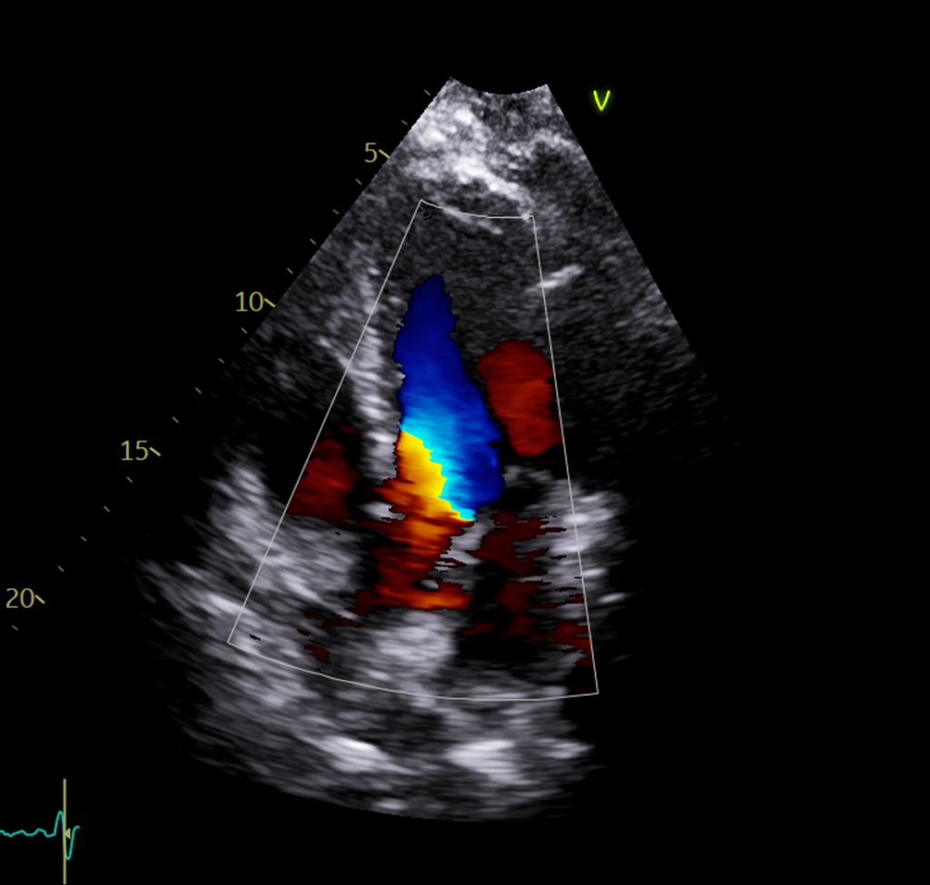 Ultrasound exam from Alberta clinic, Insight Medical Imaging