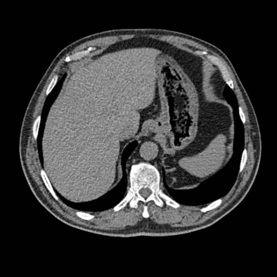 Abdomen Ct Insight Medical Imaging