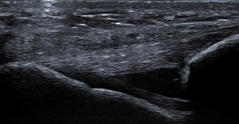 msk ultrasound ultrasound imaging scan