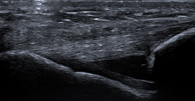 Musculoskeletal MSK Ultrasound Insight Medical Imaging