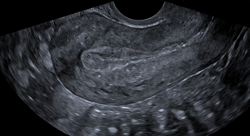 Parts Of Male Reproductive Organs : Ultrasound Pelvic | Bocghewasu