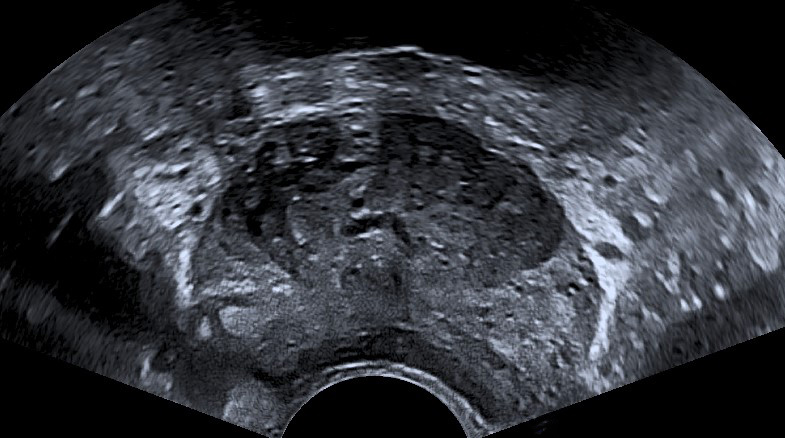 Testicular Ultrasound Insight Medical Imaging 5926