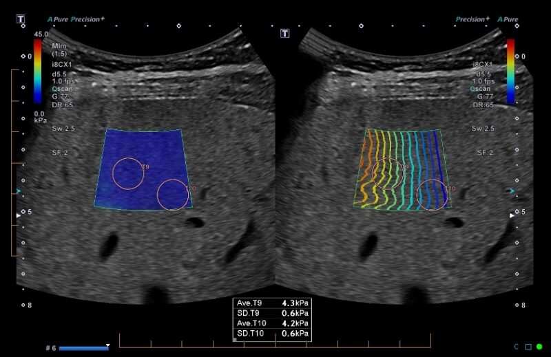 Ultrasound Exams in Edmonton, Alberta Insight Medical Imaging