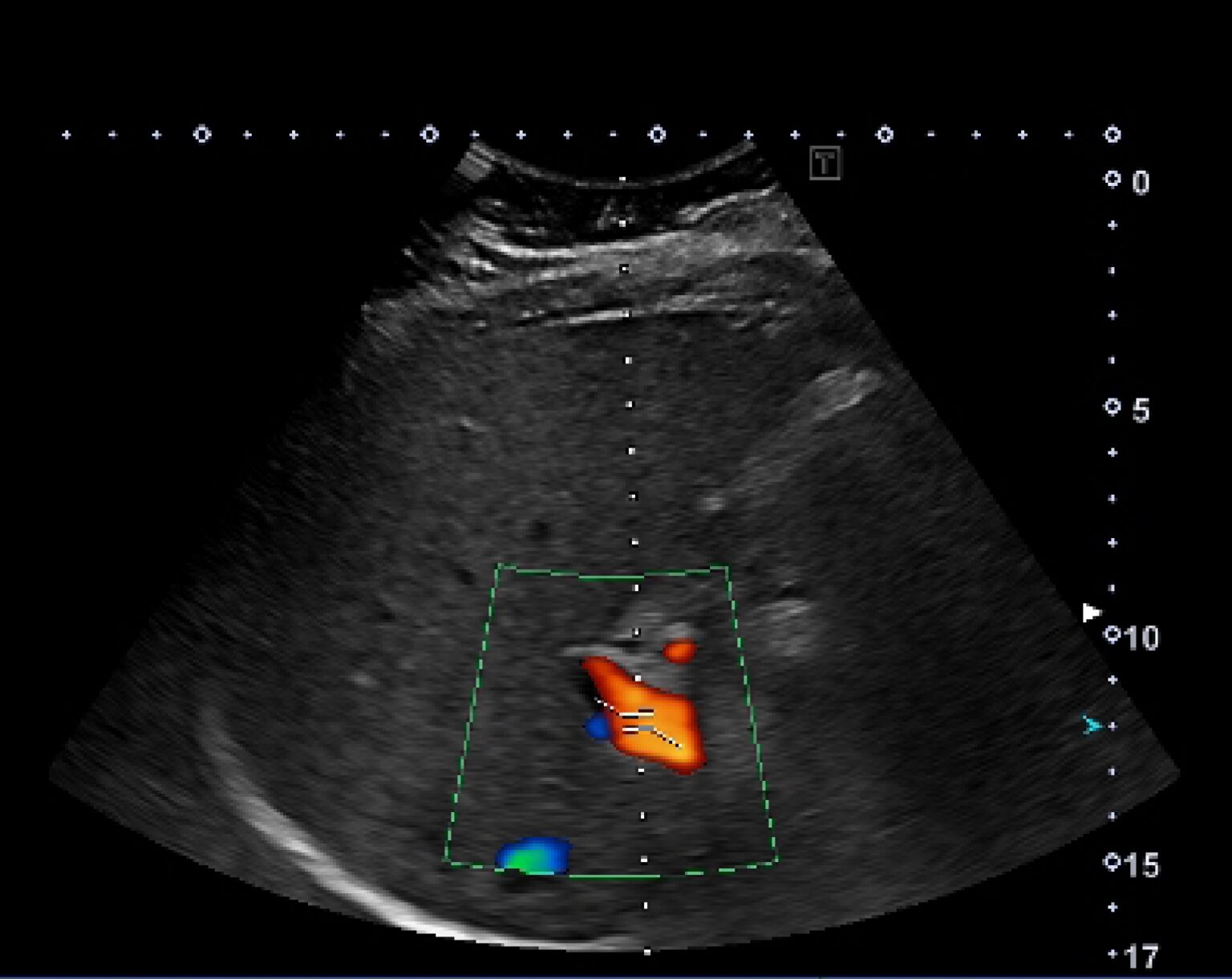 Ultrasound Exams In Edmonton Alberta Insight Medical Imaging   Hcc Image 1536x1221 